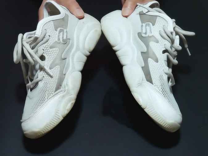 白鞋发黄别急着扔 这些救鞋妙招让你鞋柜重获新生